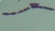 <p><b>Fig. 133:3.</b> Gram staining of <i>Bacillus subtilis</i> subsp. <i>subtilis</i>. The staining has not been efficient on all cells.</p>

<p> </p>