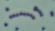 <p><strong>Fig. 15:5.</strong> Gram staining of <i>Streptococcus equi</i> subsp. <i>zooepidemicus</i>.</p>

<p> </p>