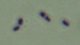 <p><b>Fig. 10:7.</b> Gram staining of <i>Rhodococcus hoagii</i>.</p>

<p> </p>