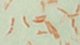 <p><strong>Fig. 86:3.</strong> Gram-färgning av <i>Aeromonas hydrophila</i> subsp. <i>hydrophila</i>.</p>

<p> </p>