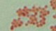 <p><strong>Fig. 87:3.</strong> Gram staining of <i>Aeromonas salmonicida</i> subsp. <i> salmonicida</i>.</p>

<p> </p>