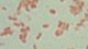 <p><strong>Fig. 77:2.</strong> Gram staining of <i>Yersinia enterocolitica</i> subsp. <i>enterocolitica</i>.</p>

<p> </p>