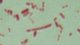 <p><strong>Fig. 103:2</strong> Gram staining of <i>Fusobacterium</i> sp.</p>

<p> </p>