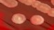 <p><strong>Fig. 21:2.</strong> Colonies of <em>Bacillus cereus</em> cultivated on bovine blood agar. Note the strong hemolysis zone. The total length of the scale bar corresponds to 10 mm.</p>

<p> </p>