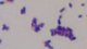 <p><strong>Fig. 13:3.</strong>Gram staining of <i>Listeria monocytogenes</i>, strain SLV365.</p>

<p> </p>