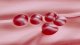 <p><strong>Fig. 13:2.</strong> Close up of colonies of <i>Listeria monocytogenes</i>, strain SLV 365, cultivated during 24 h at 37°C on bovine blood agar. The total length of the scale bar is equivalent to 5 mm.</p>

<p> </p>