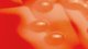 <p><strong>Fig. 15:3.</strong> Close up of colonies of <i>Streptococcus equi</i> subsp. <i>zooepidemicus</i> cultivated on bovine blood agar. Photography with <strong>lighting from below</strong>. The total length of the scale bar is equivalent to 5 mm.</p>

<p> </p>