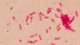 <p><strong>Fig. 61:5. </strong>Gram staning of <i>Nicoletella semolina</i>, strain BKT 9455/08.</p>

<p> </p>