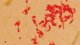 <p><strong>Fig. 61:6. </strong>Gram staning of <i>Nicoletella semolina</i>, strain BKT 9455/08.</p>

<p> </p>