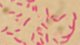 <p>Gram staining of <i>Vibrio vulnificus</i>. Note the apperance of the curved rods.</p>

<p> </p>