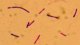 <strong>Fig. 24:5.</strong> Gram staining of <i>Clostridium botulinum</i>, type C, strain BKT 218387/08. Clostridium spp. can be difficult to gram stain (they are gram labile). <p>