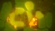 <p><strong>Fig. 45:1.</strong> Acridine orange staining for <i>Anaplasma phagocytophilum</i> of blood smear. Erythrocytes are surrounding granulocyte with a nucleus. In the granulocyte it is possible to see a morulae with tightly packed anaplasmas as well as some free anaplasmas.</p>

<p> </p>