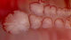 <p><strong>Fig. 25:2.</strong> Close-up of colonies of <i>Clostridium chauvoei</i>, strain JF3703, cultivated on bovine blood agar during 3 days at 37°C under anaerobic conditions. The total length of the scale bar is equivalent to 5 mm. The strain originates from Professor Joachim Frey, Bern.</p>

<p> </p>