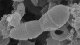 <p>Scanning electron micrograph of <i>Melissococcus plutonius</i>. Intact bacteria are visible in the center of the image. Note that the bacteria excists as diplococci and it is possible to imagine where they are going to divide the next time. The total length of the scale bar corresponds to 1 µm.</p>

<p> </p>