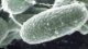<p><strong>Fig. 5:3.</strong> Scanning electron micrograph of <i>Mycobacterium avium</i> subsp. <i>paratuberculosis</i>. The image is published with permission from Johne´s Testing Center, University of Wisconsin - Madison, USA (http://www.johnes.org/).</p>

<p> </p>
