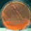 <p><b>Fig. 1.</b> Colonies of <i>Yersinia pestis</i>, strain Bombay 1 (which is virulent), cultivated on BHI Agar containing 0.05% congo red and 1% galactose. The agar plate has been incubated at 20°C during 48 h. Colonies of virulent strains, which possess the <i>pgm</i> locus for pigmentation, get a redish colour, whereas colonies of non-virulent strains are white (cf. Fig. 2).</p>

<p> </p>