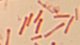 <p><strong>Fig. 104:3.</strong> Gram staining of <i>Dichelobacter nodosus</i>, strain .....</p>

<p> </p>