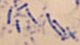 <p><strong>Fig. 104:2.</strong> Methylene blue (MB) staining of <i>Dichelobacter nodosus</i>, strain .... Note the typical dark granulae, particularly close to the ends, which can be visualized by MB staining.</p>

<p> </p>