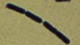 <p><strong>Fig. 21:5.</strong> Gram staining of <em>Bacillus cereus</em>, strain VB 002/09.</p>

<p> </p>