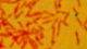 <p><strong>Fig. 64:3.</strong> Gram staining of <i>Legionella pneumophila</i> subsp.<i>pneumophila</i>, strain 28/93. Carbol fuchsin has been used instead of saffranin for the contrast staining.</p>

<p> </p>