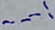 <p><b>Fig 3. </b>Gram staining of <i>Erysipelothrix rhusiopathiae</i>. Note the "cheese doodle" like appearence. The length of the scale bar is equivalent to 5 µm. Date: 2010-06-03.</p>

<p> </p>