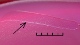 <p><b>Fig. 2. </b>Close up of colonies of <i>Clostridium tetani</i>, strain PAT 2483/10, cultivated anaerobically on FAA plates during 1 week at 37°C. A streak was performed with a plastic loop to show that bacteria are collected at the edges of the streak (see the arrow). The total length of the scale bar corresponds to 5 mm. The bacteria originate from a closed case of wound infection of a sheep. Date: 2010-06-10.</p>

<p> </p>