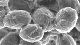<p><strong>Fig. 11:4.</strong> Spores of <i>Bacillus anthracis.</i> This strain is of biotype Pasteur. Different strains of <i>B. anthracis</i> form spores, which can be of two morphological types, either almost sphaeric or more elongated. The depicted strain forms almost sphaeric spores (c.f. Fig. 11:5). The length of the scale bar corresponds to 1 µm.</p>

<p> </p>