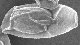 <p><strong>Fig. 21:4.</strong> Spores of <em>Bacillus cereus</em>, strain NVH 0597-99. This strain produces an exosporium, which is clearly visible (see the arrow) and is smeared as a plastic bag around the spore (c.f. Fig. 3.). Spores of <em>B. anthracis</em> and <em>B. thuringiensis</em> are also surrounded by an exosporium, which thus, is another coat that overlies the normal spore coat. The length of the scale bar is equivalent to 1 µm. Date: 2010-06-16.</p>

<p> </p>