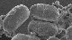 <p><strong>Fig. 133:2.</strong> Spores of <em>Bacillus atrophaeus</em>. This species forms spores, which can be distinguished from spores of <em>B. anthracis, B. cereus</em> and <em>B. thuringiensis </em>by the fact that they lack the exosporium as <em>B. subtilis</em> (c.f. Fig. 21:4). <em>B. atrophaeus </em>and <em>B. subtilis</em> are very closely related and have similar spores. The length of the scale bar is equivalent to 2 µm. Date: 2010-06-16.</p>

<p> </p>