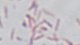 <b>Fig 138:3.</b> Gram staining of <i>Bartonella henselae</i>, strain Bart 198/03. The length of the scale bar is equivalent to 5 µm. Date: 2010-09-09.
<p>