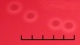 <p><b>Fig. 67:2.</b> Closeup of colonies of <i>Moraxella bovis</i>, strain BKT 14841/10, cultivated on horse blood agar during 24 h at 37°C in the presence of 5% CO<sub>2</sub>. Note the hemolysis around the colonies. Light from below. The length of the scale bar is equivalent to 5 mm. Date: 2010-10-06.</p>

<p> </p>