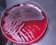<p><b>Fig. 65:2.</b> Colonies of <i>Pseudomonas aeruginosa</i>, strain ATCC 27853, cultivated aerobically on horse blood agar during 3 days at 37°C. Note the typical metallic sheen of the colonies, which can be observed in certain lighting (cf. Fig 65:1). The length of scale bar is equivalent to 1 cm. Date: 2010-10-06.</p>

<p> </p>