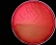 <b>Fig. 65:1.</b> Colonies of <i>Pseudomonas aeruginosa</i>, strain ATCC 27853, cultivated aerobically on horse blood agar during 3 days at 37°C. Light from below. The length of scale bar is equivalent to 1 cm. Date: 2010-10-06. <p>