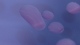 <p><b>Fig. 10:6.</b> Closeup of colonies of <i>Rhodococcus hoagii</i> strain ..., cultivated aerobically on purple lactose agar during 48 h at 37°C. The lighting was from above. Note the slimy, semi-fluid colonies wiyh pink colour. The length of the scale bar is equivalent to 5 mm. Date: 2011-02-02.</p>

<p> </p>