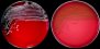 <p><b>Fig. 205:1.</b> Colonies of <i>Staphylococcus epidermidis</i>, strain VB 005/11, cultivated aerobically on bovine blood agar at 37°C during 48 h. The length of the scale bars is equivalen to 1 cm. A, Photographed with light from above. B, Photographed with light from primarily below. Note that hemolysis cannot be observerved for this particular strain. Date: 2011-02-25.</p>

<p> </p>