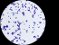 <p><b>Fig. 205:4.</b> Gram staining of <i>Staphylococcus epidermidis</i>, strain VB 005/11. The length of the scale bar is equivalent to 5 µm. Date: 2011-03-14.</p>

<p> </p>