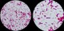 <p><b>Fig. 65:6.</b>Gram staining of <i>Pseudomonas aeruginosa</i>, strain ATCC 27853. The field B is a partial magnification (3 times) of A. The length of the scale bar corresponds to 5 µm. Date: 2011-03-24.</p>

<p> </p>