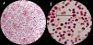 <p><b>Fig. 67:4.</b> Gram staining of <i>Moraxella bovis</i>, strain BKT 14841/10. The arrows indicate bacteria that appear in pairs (common). The field B is a partial magnification (6 times) of A. The lengths of the scale bars corresponds to 5 µm. Date: 2011-03-24.</p>

<p> </p>