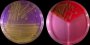 <p><b>Fig. 207:4.</b> Colonies of <i>Streptococcus canis</i>, strain CCUG37323, cultivated on A, purple agar (with lactose) and B, SELMA plate (SElective MAstitis medium). The colonies are rather small on purple agar, but it is evident that this bacterium ferments lactose. The SELMA plate contains a, bovine blood agar with esculine, b, mannitol salt agar and c, Mac Conkey agar. <i>S. canis</i> is only growing in field a, where most aerobic (and facultatively aerobic) bacteria can be grown. <i>S. canis</i> is esculinase positive. The length of the scale bar is equivalent to 1 cm. Date: 2011-06-08.</p>

<p> </p>