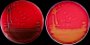 <b>Fig 207:1.</b> Colonies of <i>Streptococcus canis</i>, strain CCUG 37323, cultivated aerobically on bovine blood agar with aesculine at 37 °C during 24 h. A, Photographed with lighting from above. Note the dark colour of the agar plate. <i>S. canis</i> is easculinase positive. B, Photographed with lighting from below. Note the relatively broad hemolysis zone, which can be observed around the colonies on plate B. The length of the scale bar is equivalent to 1 cm. Date: 2011-06-08. <p>