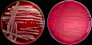 <p><b>Fig 69:1.</b> Colonies of <i>Klebsiella pneumoniae</i> subsp. <i>pneumoniae</i>, strain CCUG 225, cultured aerobically on horse blood agar at 37°C during 24 h. A, Photographed with lighting from above. B, Photographed with lighting from primarily below. Note that an hemolysis zone cannot be observed. The length of the scale bar is equivalent to 1 cm. Date: 2011-06-16.</p>

<p> </p>