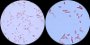 <p><b>Fig 156:5.</b> Gram staining of <i>Klebsiella oxytoca</i>, strain CCUG 15717 at two different degrees of magnification (A and B). The lengths of the scale bars are equivalent to 5 µm in both images. Date: 2011-08-30.</p>

<p> </p>