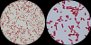<p><b>Fig 69:4.</b> Gram staining of <i>Klebsiella pneumoniae</i> subsp. <i>pneumoniae</i>, strain CCUG 225 at two different degrees of magnification (A and B). The lengths of the scale bars are equivalent to 5 µm in both images. Date: 2011-08-30.</p>

<p> </p>