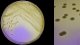 <p><b>Fig. 135:5.</b> Colonies of <i>Staphylococcus pseudintermedius</i>, strain SVA-MRSP 134, cultivated on purple agar with lactose at 37°C during 24 h. A, The length of the scale bar is equivalent to 1 cm. B, A partial close-up of A, which is photographed from another angle. The total length of the scale bar is equivalent to 5 mm. Note that <i>S. pseudintermedius</i> is a lactose fermenter.</p>

<p> </p>