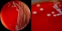 <b>Fig. 68:1.</b> Colonies of <i>Escherichia coli</i>, strain SLV 082, cultivated aerobically on blood agar at 37°C during 24 h. Photographed with lighting from primarily above. A, overview; B, close-up. The lengths of the scale bars are equivalent to 10 and 5 mm, respectively. Date: 2012-03-01.
<p>