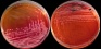 <p><strong>Fig. 70:7.</strong> Colonies of <i>Salmonella enterica</i> subsp. <i>enterica</i>, serovar Diarizonae, cultivated aerobically on BG agar (A) and XLD+N-agar (B) at 37°C during 24 h. Note that there is no yellow colour around the colonies (in A) since salmonellas are lactose negative and black colonies (in B). The length of the scale bars is equivalent to 1 cm.</p>

<p> </p>