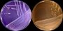 <p><b>Fig. 53:3</b>. Colonies of <i>Bordetella bronchiseptica</i>, strain xxx, cultivated on A, purple agar with lactose and B, McConkey agar at 37°C during 48 h. The length of the scale bars corresponds to 10 mm.</p>

<p> </p>