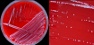 <p><strong>Fig. 169:1.</strong> Colonies of <i>Corynebacterium kutscheri</i>, strain JF5392, cultivated on TSA with 5% sheep blood during 24 h at 37°C and with 5% CO<sub>2</sub>. The strain was isolated from a lymph node, with pathological lesions, from the lung of a mouse. A, overview av the agar plate. The total length of the scale bar is equivalent to 1 cm. B, partial close-up of A. The total length of the scale bar is equivalent to 5 mm. Note the very small colonies.</p>

<p> </p>