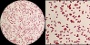 <p><strong>Fig. 68:3.</strong> Gram staining of <i>Escherichia coli</i>, strain VB 008/14. The right image is a partial magnification (2.5x) of the left one. The total length of the respective scale bars is equivalent to 5 µm and the scale bars are placed in the corresponding areas of the images. Date: 2013-12-23.</p>

<p> </p>

<p> </p>