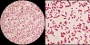 <p><strong>Fig. 73:3.</strong> Gram staining of <i>Proteus vulgaris</i>, strain SLV 476. The right image is a partial magnification (2.5x) of the left one. The total length of the respective scale bars is equivalent to 5 µm and the scale bars are placed in the corresponding areas of the images. Date: 2013-12-23.</p>

<p> </p>

<p> </p>